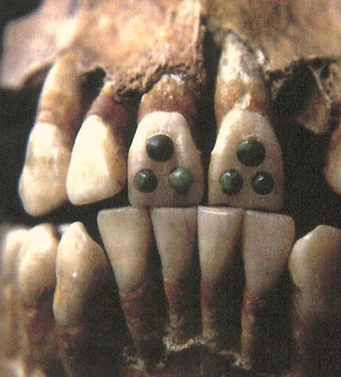 An example of a Maya teeth featuring a gemstone in inlay modification.