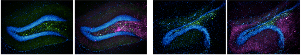 Stained tissue sections of an uninjured and injured brain region
