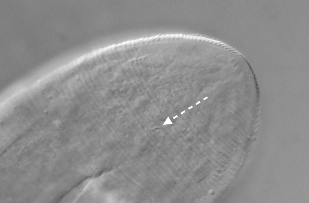 Microscope image of the posterior end of the anus of a Demodex folliculorum mite. The presence of an anus on this mite had been wrongly overlooked by some previously, but this study confirmed its presence.