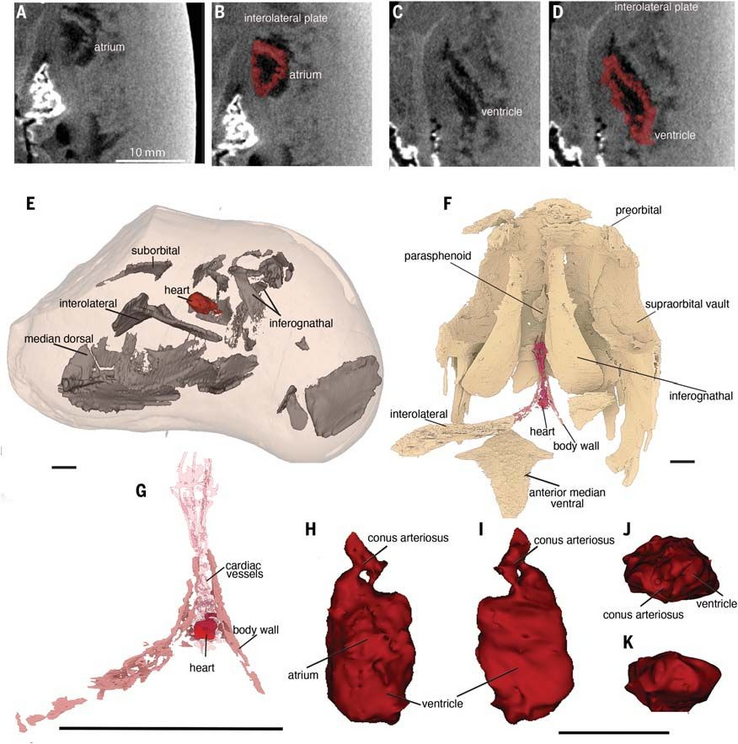 The scan revealed incredible details about the heart, including ventricles and atria.