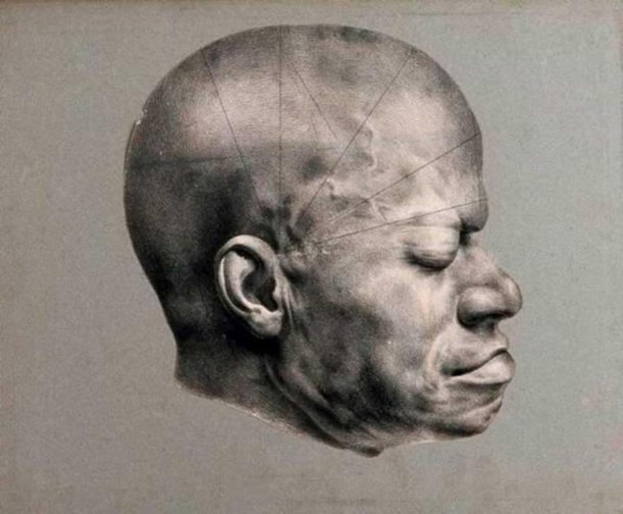 Death mask of Eustache, a slave from the Dominican Republic who came to be awarded a 'prize for virtue' in 1830's Paris. Lithograph, c. 1835. (Public Domain). Eustache’s death mask was used in the study of phrenology. The lines drawn across the head refer