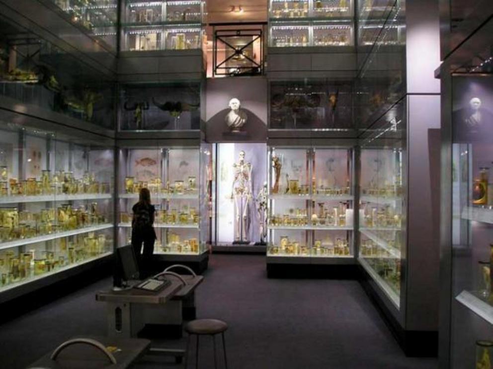 The many exhibits of the human anatomy at the Hunterian Museum.