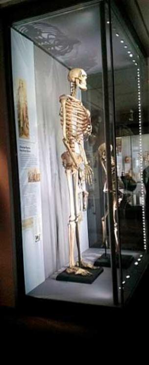 The skeleton of the 7’ 7” (2.13 meters) Charles Byrne as it was exhibited at the Hunterian Museum.