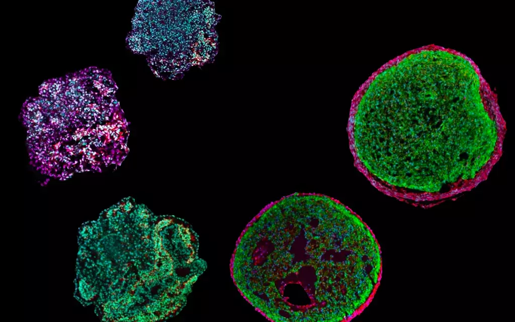 A Miniature Heart In A Petri Dish: Organoid Emulates Development Of The ...