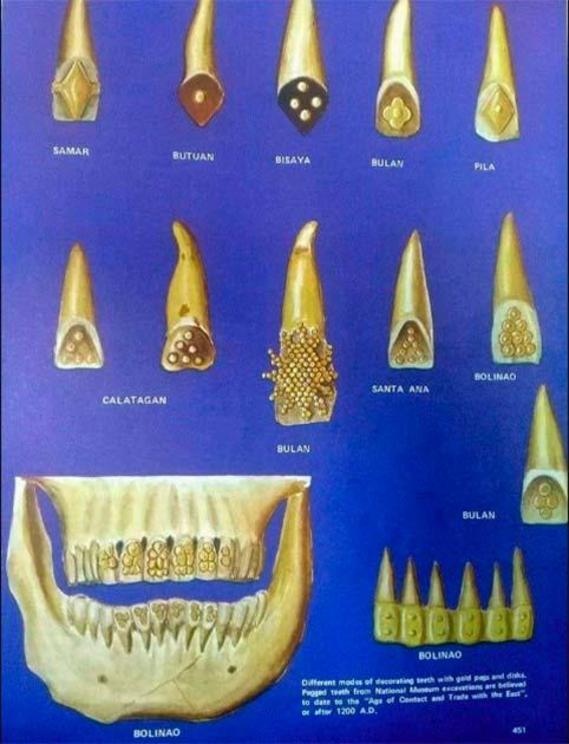 It was fashionable and prestigious back then to have your teeth filed and filled with gold. Early Philippine tradition includes dental modification as a type of personal styling and ornamentation