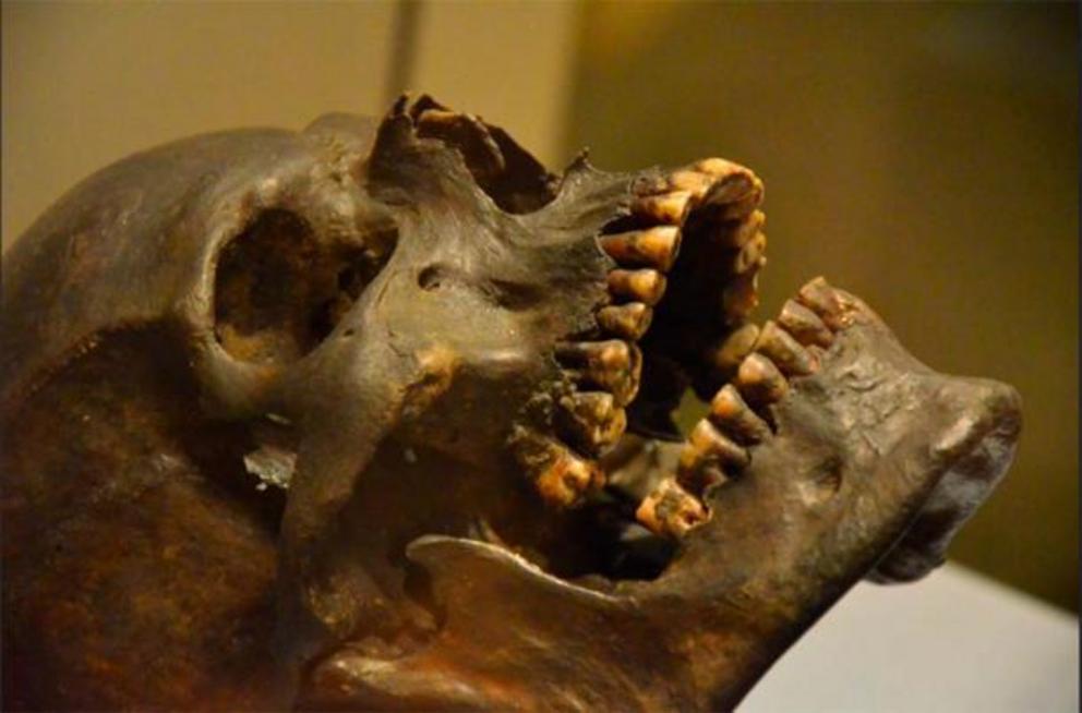 Teeth of Gristhorpe Man