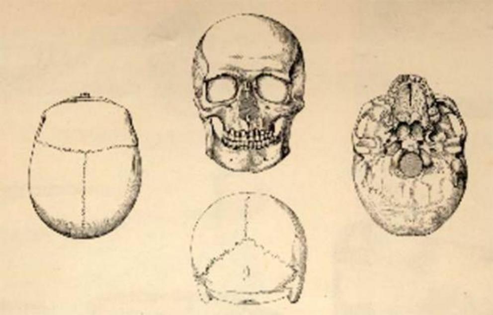 Drawings of the Gristhorpe Man's Skull, J. and W.C. Williamson