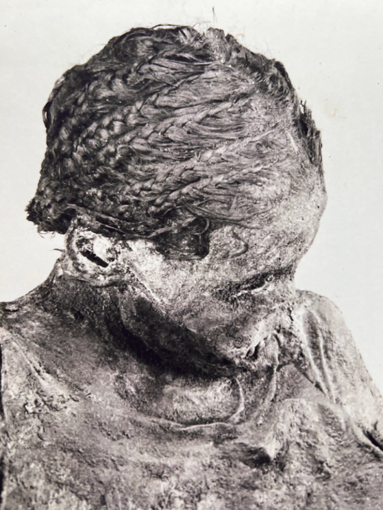 A photograph of the now-missing head of the mummy, taken during excavations in 1908.